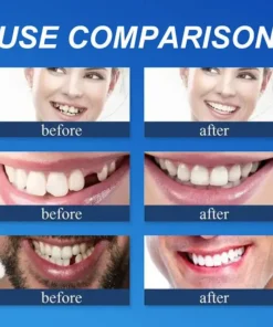 CLINCLII™ --Advanced Customized Full Denture Set