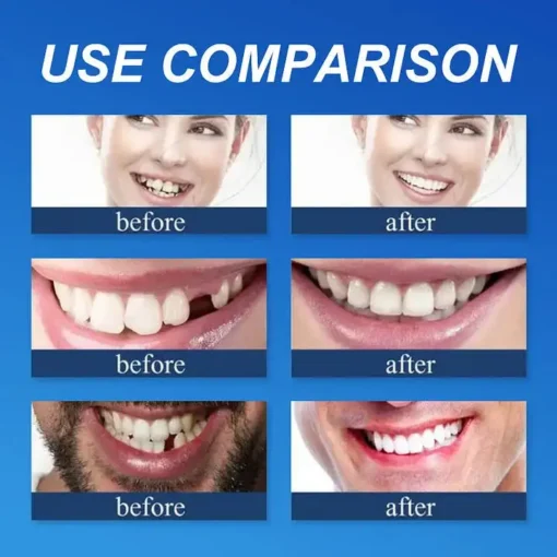 CLINCLII™ --Advanced Customized Full Denture Set