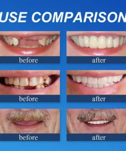 CLINCLII™ --Advanced Customized Full Denture Set