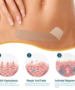 Clinclii™ Hyaluronic Acid Nano Microneedle Repair Tape