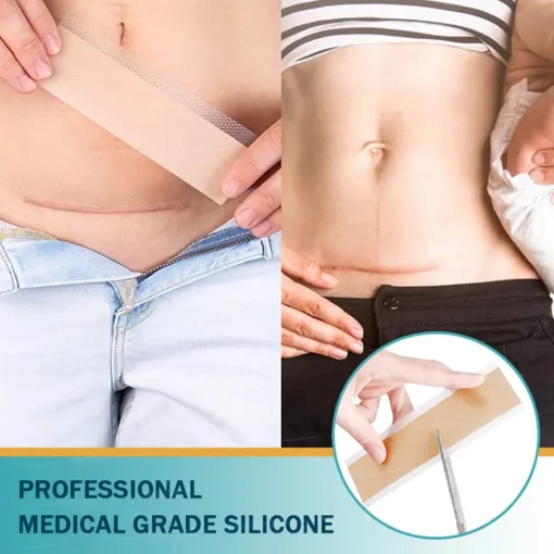 Clinclii™ Hyaluronic Acid Nano Microneedle Repair Tape