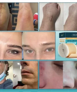 Clinclii™ Hyaluronic Acid Nano Microneedle Repair Tape