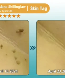 Clinclii™ Hyaluronic Acid Nano Microneedle Repair Tape