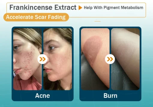 Clinclii™ Hyaluronic Acid Nano Microneedle Repair Tape