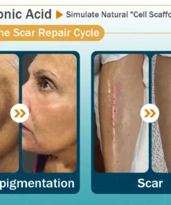 Clinclii™ Hyaluronic Acid Nano Microneedle Repair Tape