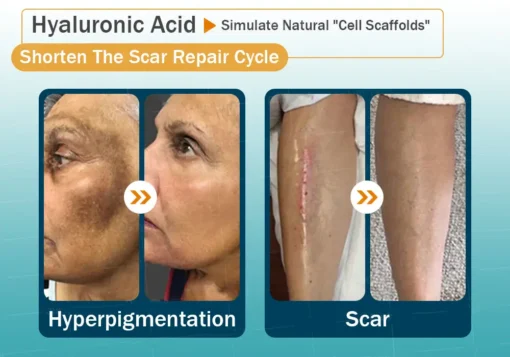 Clinclii™ Hyaluronic Acid Nano Microneedle Repair Tape