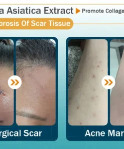 Clinclii™ Hyaluronic Acid Nano Microneedle Repair Tape