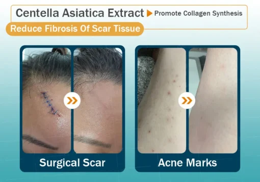 Clinclii™ Hyaluronic Acid Nano Microneedle Repair Tape