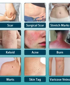 Clinclii™ Hyaluronic Acid Nano Microneedle Repair Tape