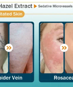 Clinclii™ Hyaluronic Acid Nano Microneedle Repair Tape