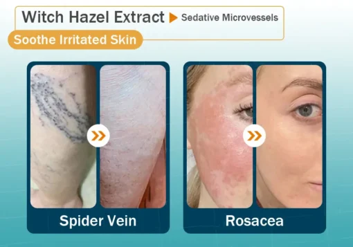 Clinclii™ Hyaluronic Acid Nano Microneedle Repair Tape