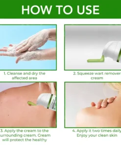 Clinclii™ NatureErase Instant Mole & Spot Cream