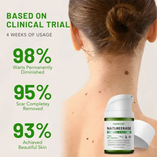 Clinclii™ NatureErase Instant Mole & Spot Cream