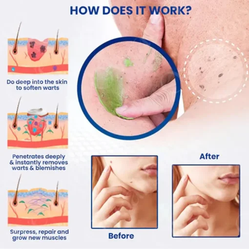 Clinclii™ NatureErase Instant Mole & Spot Cream