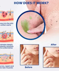 Clinclii™ NatureErase Instant Mole & Spot Cream