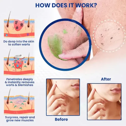 Clinclii™ NatureErase Instant Mole & Spot Cream