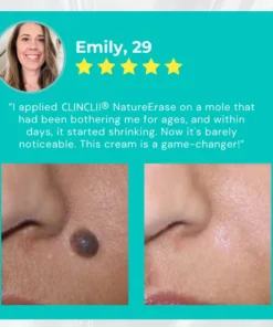 Clinclii™ NatureErase Instant Mole & Spot Cream