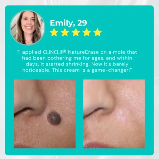 Clinclii™ NatureErase Instant Mole & Spot Cream