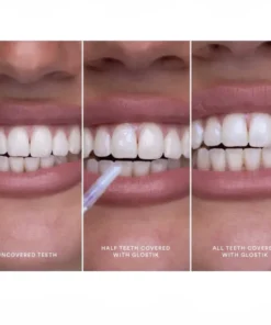 Clinclii™ Instant Glow Tooth Gloss