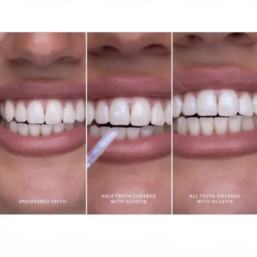 Clinclii™ Instant Glow Tooth Gloss