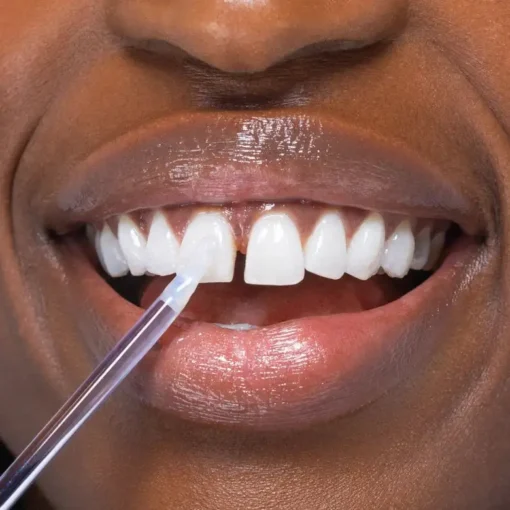 Clinclii™ Instant Glow Tooth Gloss