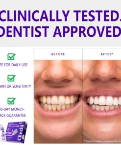 Clinclii™ V36 Whitening Strips – Professional Teeth Whitening at Home