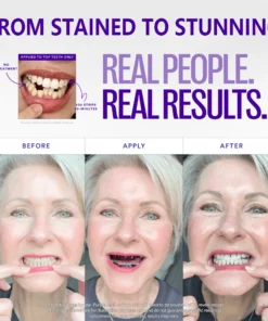 Clinclii™ V36 Whitening Strips – Professional Teeth Whitening at Home