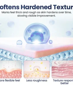 CLINCLII® Texture Repair Gel