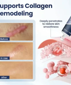 CLINCLII® Texture Repair Gel