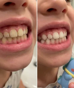 Clinclii™ Childrens Electric Toothbrush - Fun, Effective, and Kid-Approved