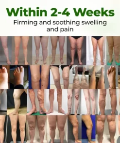 Clinclii® Professional Leg Circulation Cream