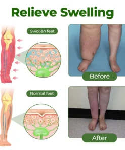 Clinclii® Professional Leg Circulation Cream