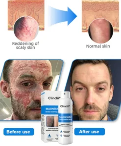 Clinclii® Magnesium Herbal Spray