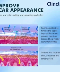 Clinclii® Medical Silicone Scar Gel