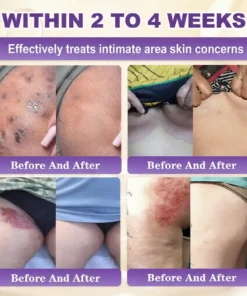 Clinclii® Biotin 10-in-1 Skin Restoration Cream