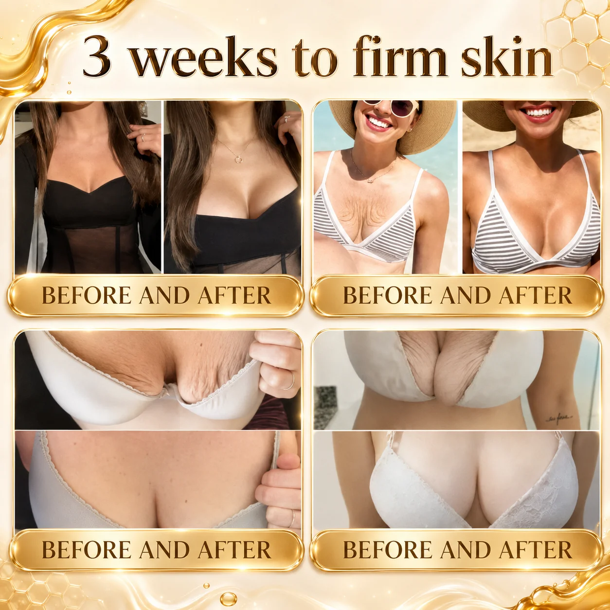 Clinclii™ Bee Venom Firm & Smooth Precision Body Roller - Image 4